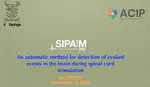 An automatic method for detection of evoked events in the brain during spinal cord stimulation
