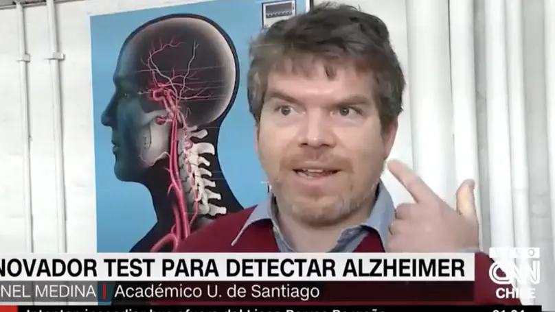 Trabajo de complejidad para identificación de Alzheimer destacado en CNN-Chile, Chilevisión y otros